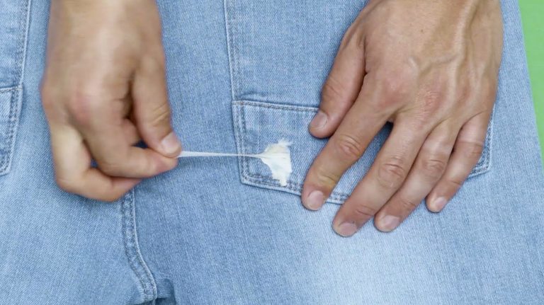 KnipTIP: kauwgom uit kleding verwijderen